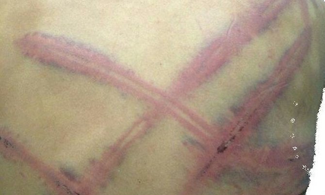 A PHOTOGRAPH showing injuries reportedly sustained by a Cuban detainee has surfaced on social media.
