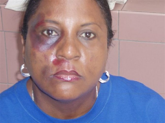 RBC employee Sandra Mackey uses makeup to show the physical scars of domestic violence.