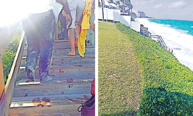 LEFT: The tourist covered in sand.
RIGHT: The stairs to the beach.