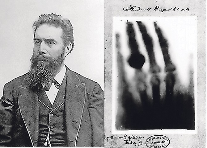 Wilhelm Roentgen’s made his first medical X-ray of his wife Anna Bertha Ludwig’s hand.