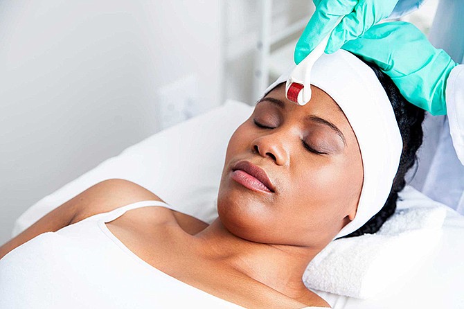 Microneedling is used for skin rejuvenation and to treat scars, acne and sun damage.