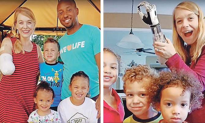 LEFT: Tiffany Johnson with her husband and three children.

RIGHT: Tiffany Johnson with her bionic arm and her children, Kylee, eight, Luke, seven, and Natalie, four.