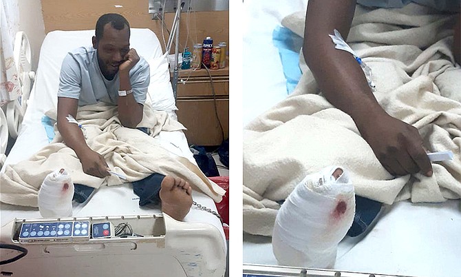 Jonathan Lightbourne in hospital with a damaged foot.