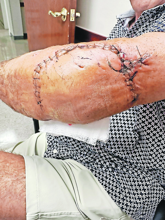 Photo: Daniel Torobekov