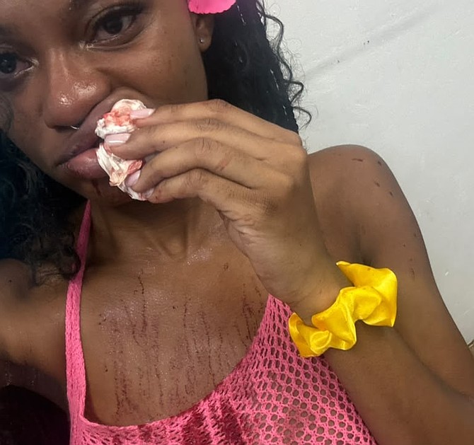 BRIANA BAZEL, 25, of Ohio alleges jet ski operator punched her in the face after she rejected his sexual advances.