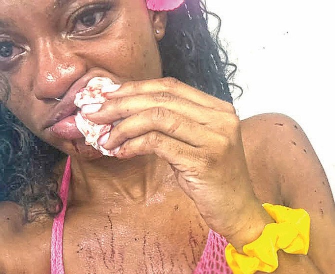 Briana Bazel of Ohio alleges man who claimed to be a jet ski operator punched her when she rejected his sexual advances.